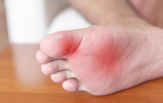 Sports Injuries