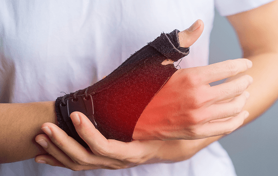 Minor Fractures & Dislocations