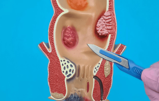 Minor Surgery